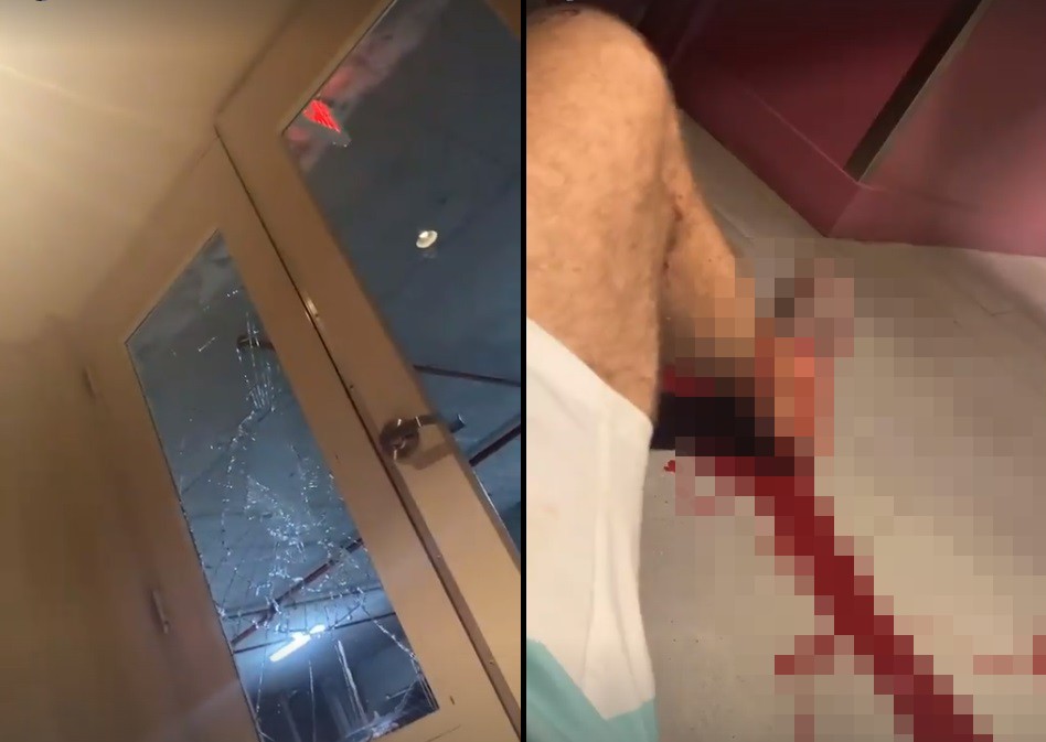 Zawodnik UFC nagrał, jak leży w kałuży krwi. Rozbił szklane drzwi? [WIDEO]